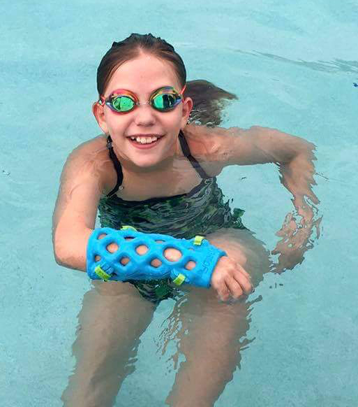 Girl in swimming pool wearing an ActivArmore cast